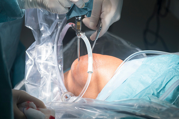 Knee Pain in Anaheim, Fullerton & Yorba Linda? When You Need Arthroscopy or Knee Replacement